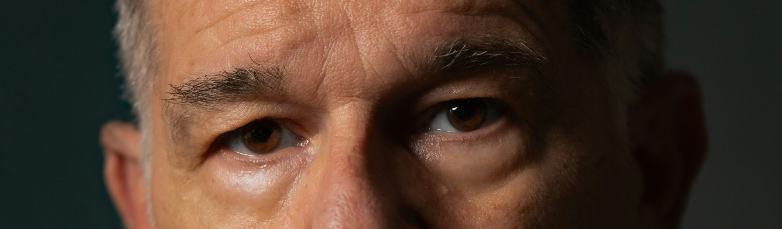 Poches sous les yeux